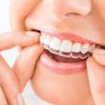 Warminster Gentle Dentistry | Orthodontic Treatment in Warminster: How Can Straighter Teeth Improve More Than Your Smile?